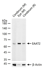 GLT-1 Recombinant Rabbit Monoclonal Antibody (5H3)