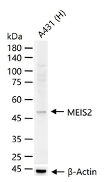 MEIS2 Antibody in Western Blot (WB)