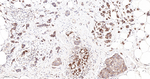 Bcl-2 Antibody in Immunohistochemistry (Paraffin) (IHC (P))