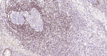 Bcl-2 Antibody in Immunohistochemistry (Paraffin) (IHC (P))