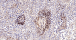 Bcl-2 Recombinant Rabbit Monoclonal Antibody (B9E6)