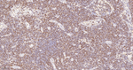 Bcl-2 Antibody in Immunohistochemistry (Paraffin) (IHC (P))
