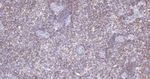 Bcl-2 Antibody in Immunohistochemistry (Paraffin) (IHC (P))