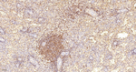 Bcl-2 Antibody in Immunohistochemistry (Paraffin) (IHC (P))