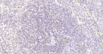 Bcl-2 Antibody in Immunohistochemistry (Paraffin) (IHC (P))