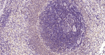 Bcl-2 Antibody in Immunohistochemistry (Paraffin) (IHC (P))
