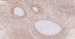 Bcl-2 Antibody in Immunohistochemistry (Paraffin) (IHC (P))
