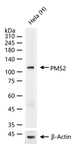 PMS2 Recombinant Rabbit Monoclonal Antibody (6G9)