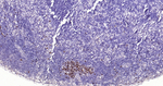 TOP2A Antibody in Immunohistochemistry (Paraffin) (IHC (P))