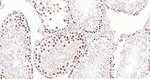 TOP2A Recombinant Rabbit Monoclonal Antibody (11D3)