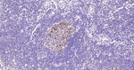 TOP2A Antibody in Immunohistochemistry (Paraffin) (IHC (P))