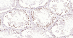 TOP2A Antibody in Immunohistochemistry (Paraffin) (IHC (P))