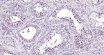 TOP2A Antibody in Immunohistochemistry (Paraffin) (IHC (P))