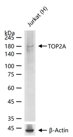 TOP2A Antibody in Western Blot (WB)