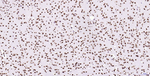 Histone H2A.X Antibody in Immunohistochemistry (Paraffin) (IHC (P))