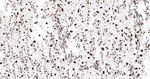 Histone H2A.X Antibody in Immunohistochemistry (Paraffin) (IHC (P))
