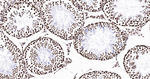 Histone H2A.X Antibody in Immunohistochemistry (Paraffin) (IHC (P))