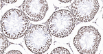 Histone H2A.X Antibody in Immunohistochemistry (Paraffin) (IHC (P))