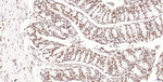 Histone H2A.X Antibody in Immunohistochemistry (Paraffin) (IHC (P))