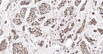 Histone H2A.X Antibody in Immunohistochemistry (Paraffin) (IHC (P))