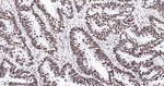 Histone H2A.X Antibody in Immunohistochemistry (Paraffin) (IHC (P))