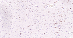 JNK1 Antibody in Immunohistochemistry (Paraffin) (IHC (P))