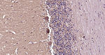 Beclin 1 Antibody in Immunohistochemistry (Paraffin) (IHC (P))