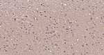 Beclin 1 Antibody in Immunohistochemistry (Paraffin) (IHC (P))