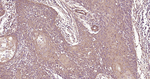 Beclin 1 Antibody in Immunohistochemistry (Paraffin) (IHC (P))