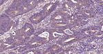 Beclin 1 Antibody in Immunohistochemistry (Paraffin) (IHC (P))