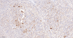Galectin 3 Antibody in Immunohistochemistry (Paraffin) (IHC (P))