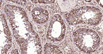 Galectin 3 Antibody in Immunohistochemistry (Paraffin) (IHC (P))