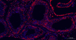Galectin 3 Antibody in Immunohistochemistry (Paraffin) (IHC (P))