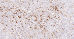 Galectin 3 Antibody in Immunohistochemistry (Paraffin) (IHC (P))