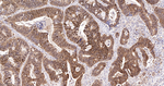 Galectin 3 Antibody in Immunohistochemistry (Paraffin) (IHC (P))