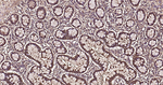 Galectin 3 Antibody in Immunohistochemistry (Paraffin) (IHC (P))