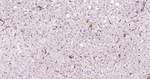 Galectin 3 Antibody in Immunohistochemistry (Paraffin) (IHC (P))