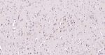 Caspase 3 p17 Antibody in Immunohistochemistry (Paraffin) (IHC (P))