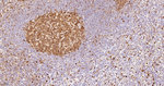 Caspase 3 p17 Antibody in Immunohistochemistry (Paraffin) (IHC (P))