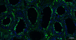 Nrf2 Antibody in Immunohistochemistry (Paraffin) (IHC (P))