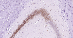 Nrf2 Antibody in Immunohistochemistry (Paraffin) (IHC (P))