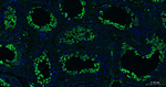 Nrf2 Antibody in Immunohistochemistry (Paraffin) (IHC (P))