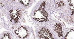 Nrf2 Antibody in Immunohistochemistry (Paraffin) (IHC (P))