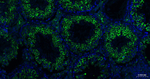 Nrf2 Antibody in Immunohistochemistry (Paraffin) (IHC (P))