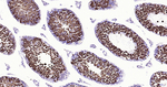 Nrf2 Antibody in Immunohistochemistry (Paraffin) (IHC (P))