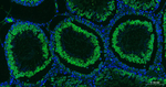 Nrf2 Antibody in Immunohistochemistry (Paraffin) (IHC (P))