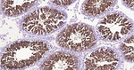 Nrf2 Antibody in Immunohistochemistry (Paraffin) (IHC (P))