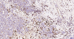 Nrf2 Antibody in Immunohistochemistry (Paraffin) (IHC (P))