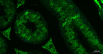 Nrf2 Antibody in Immunohistochemistry (Paraffin) (IHC (P))