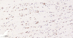 Nrf2 Antibody in Immunohistochemistry (Paraffin) (IHC (P))
